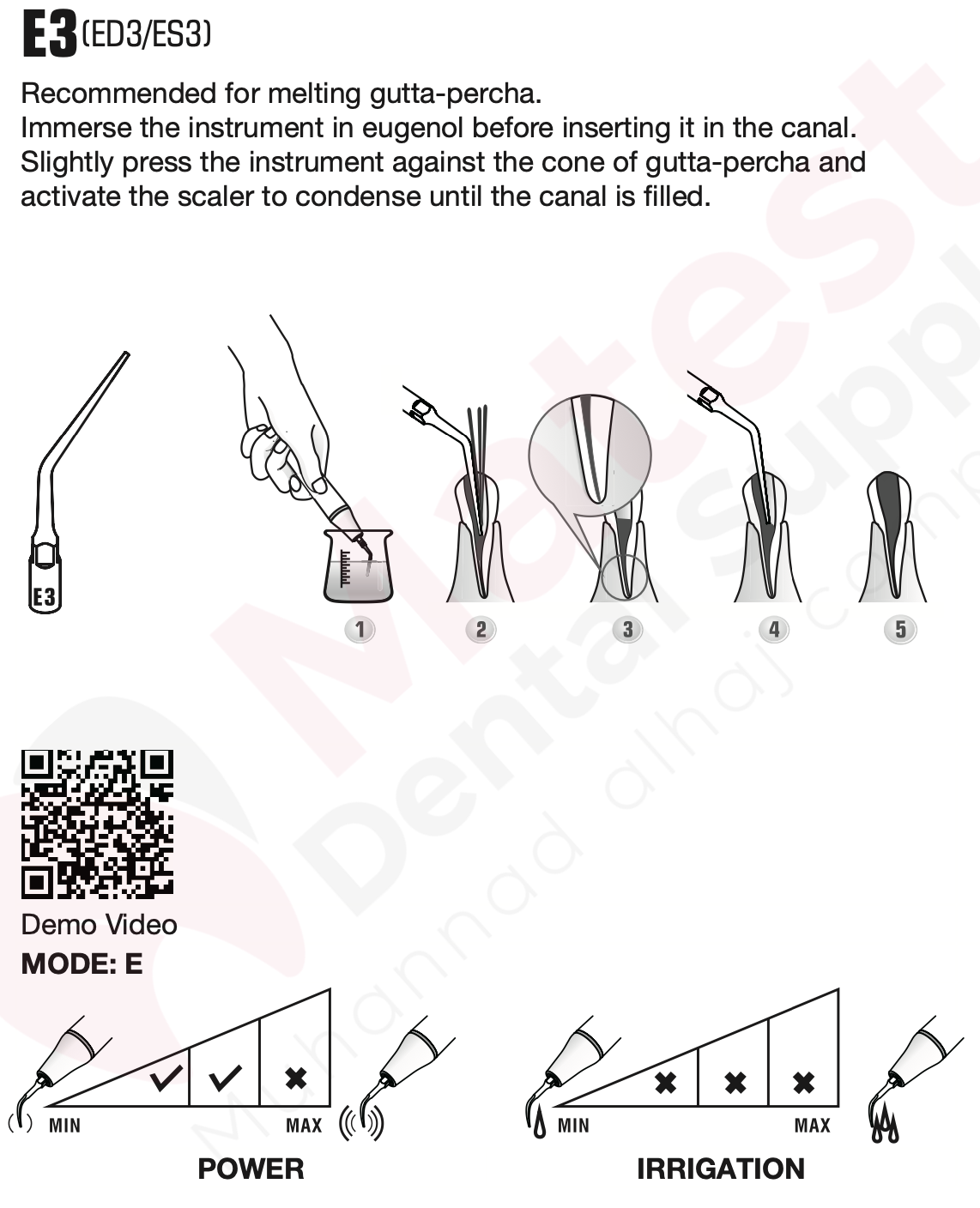 Woodpecker Endodontic UltraSonic Tips (E)