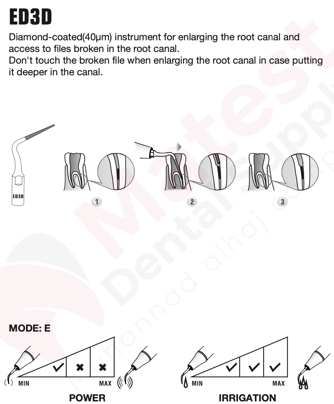 Woodpecker Endodontic UltraSonic Tips (E)