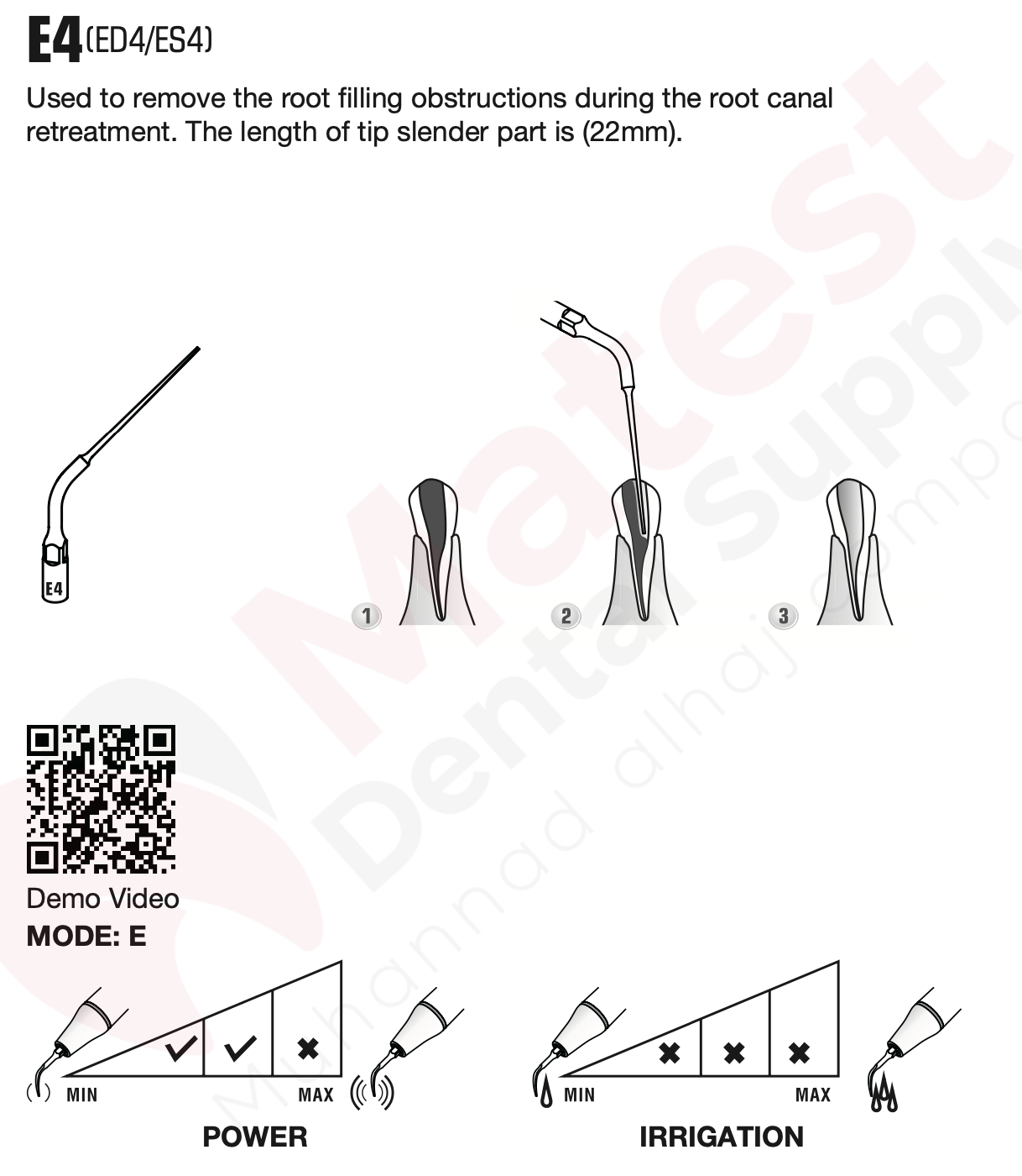 Woodpecker Endodontic UltraSonic Tips (E)