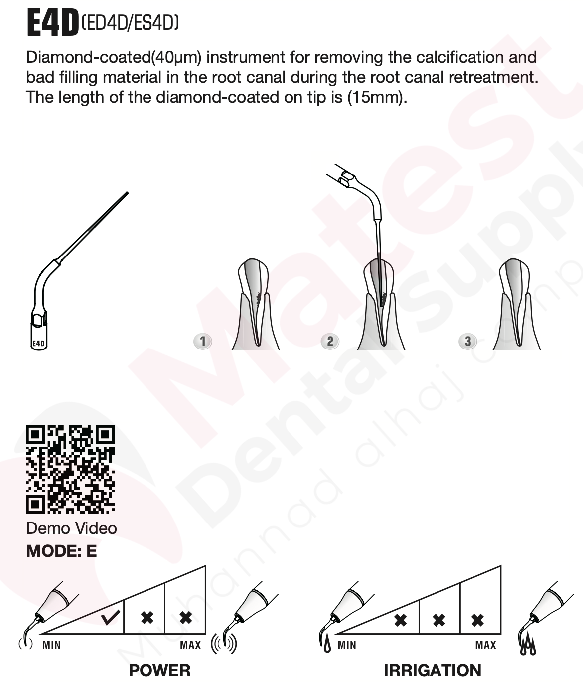 Woodpecker Endodontic UltraSonic Tips (E)