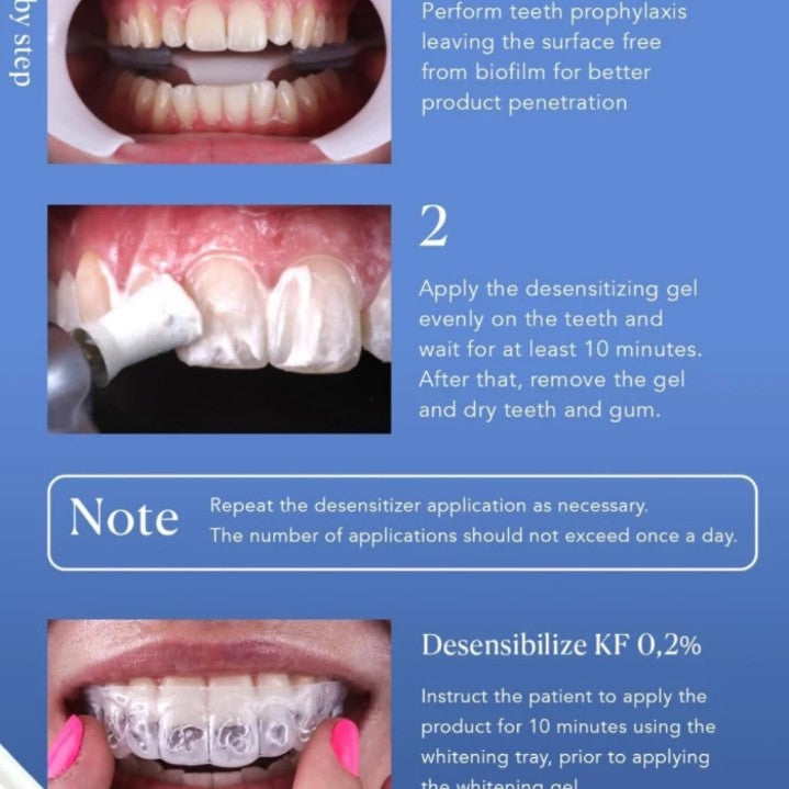 Desensibilize KF - Desensitizing Gel Based on Potassium Nitrate & Sodium Fluoride