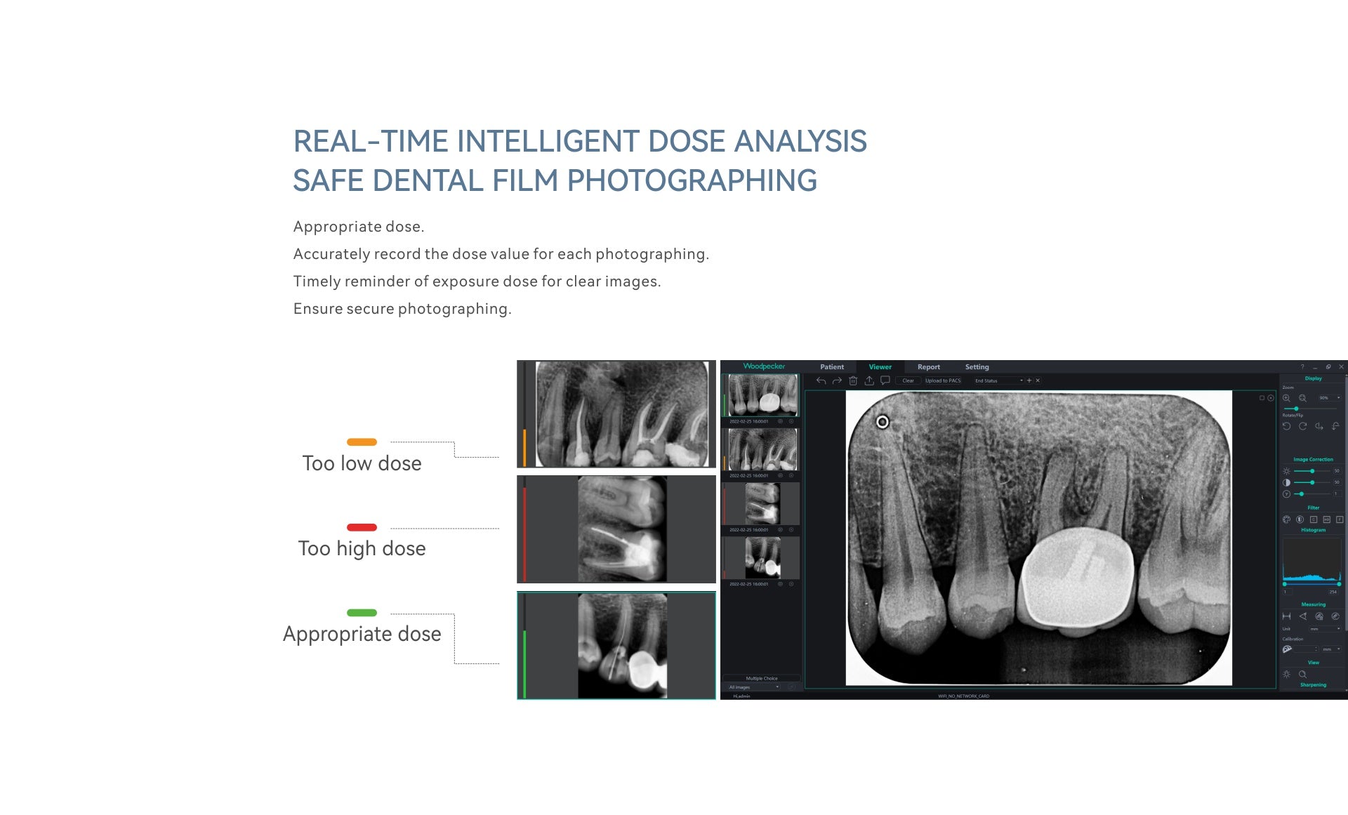 DBA - Free Scan - Dental Imaging Plate Scanner