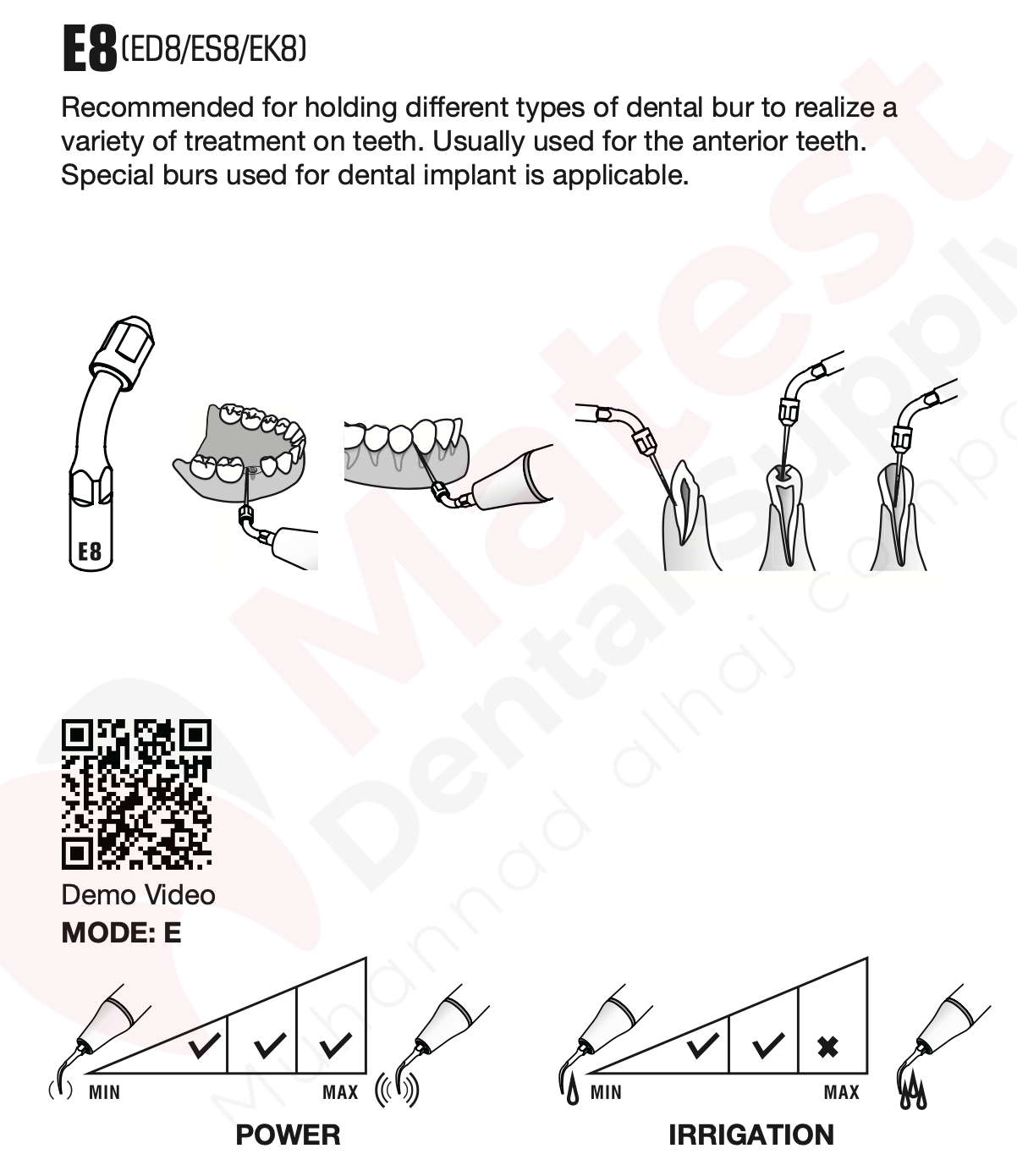 Woodpecker Endodontic UltraSonic Tips (E)