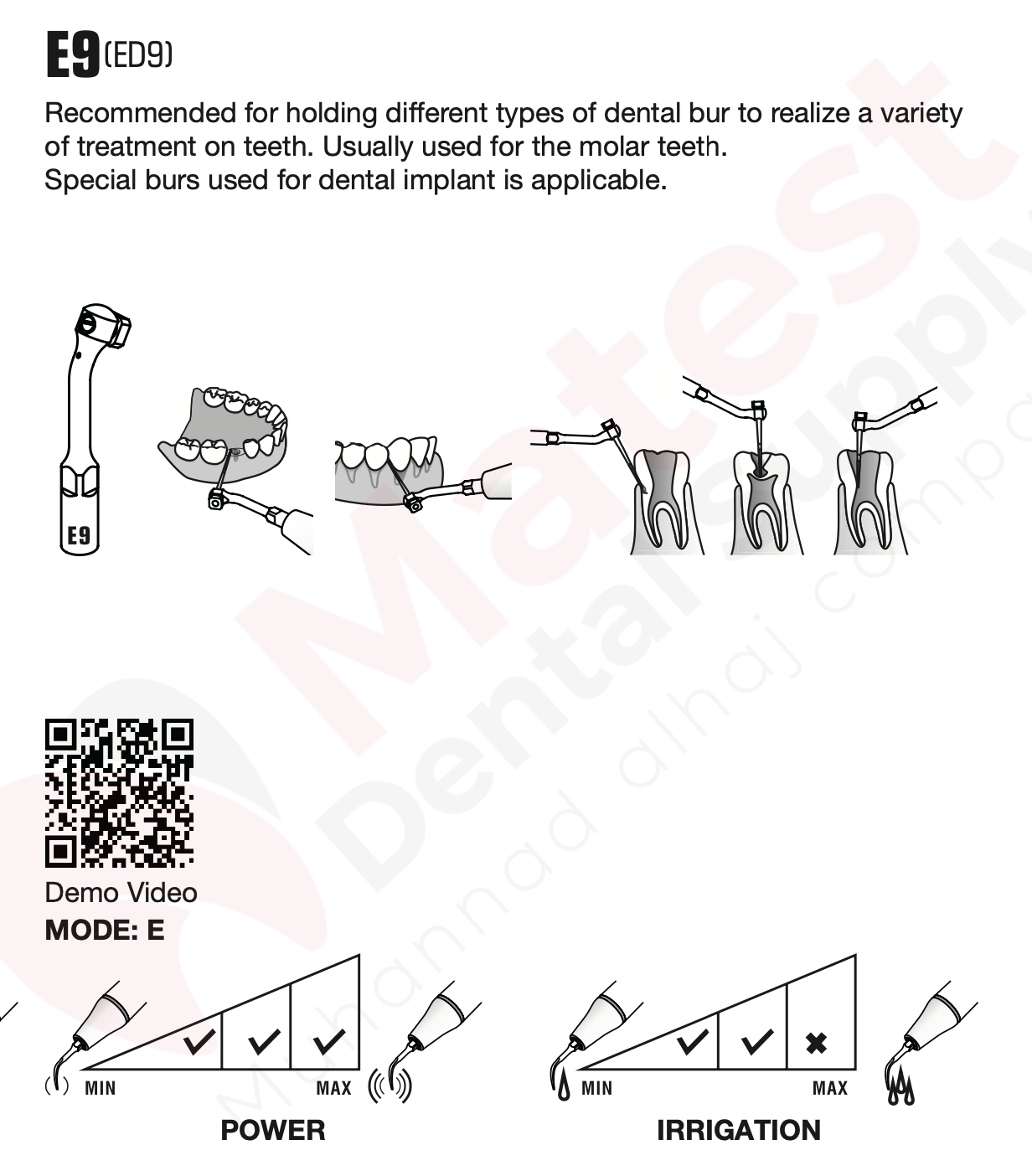 Woodpecker Endodontic UltraSonic Tips (E)