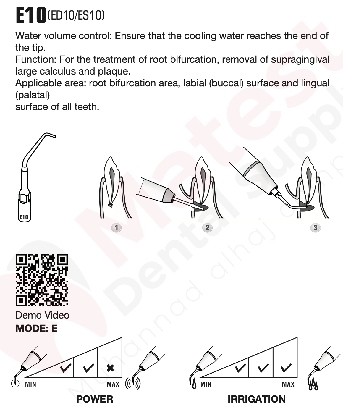 Woodpecker Endodontic UltraSonic Tips (E)