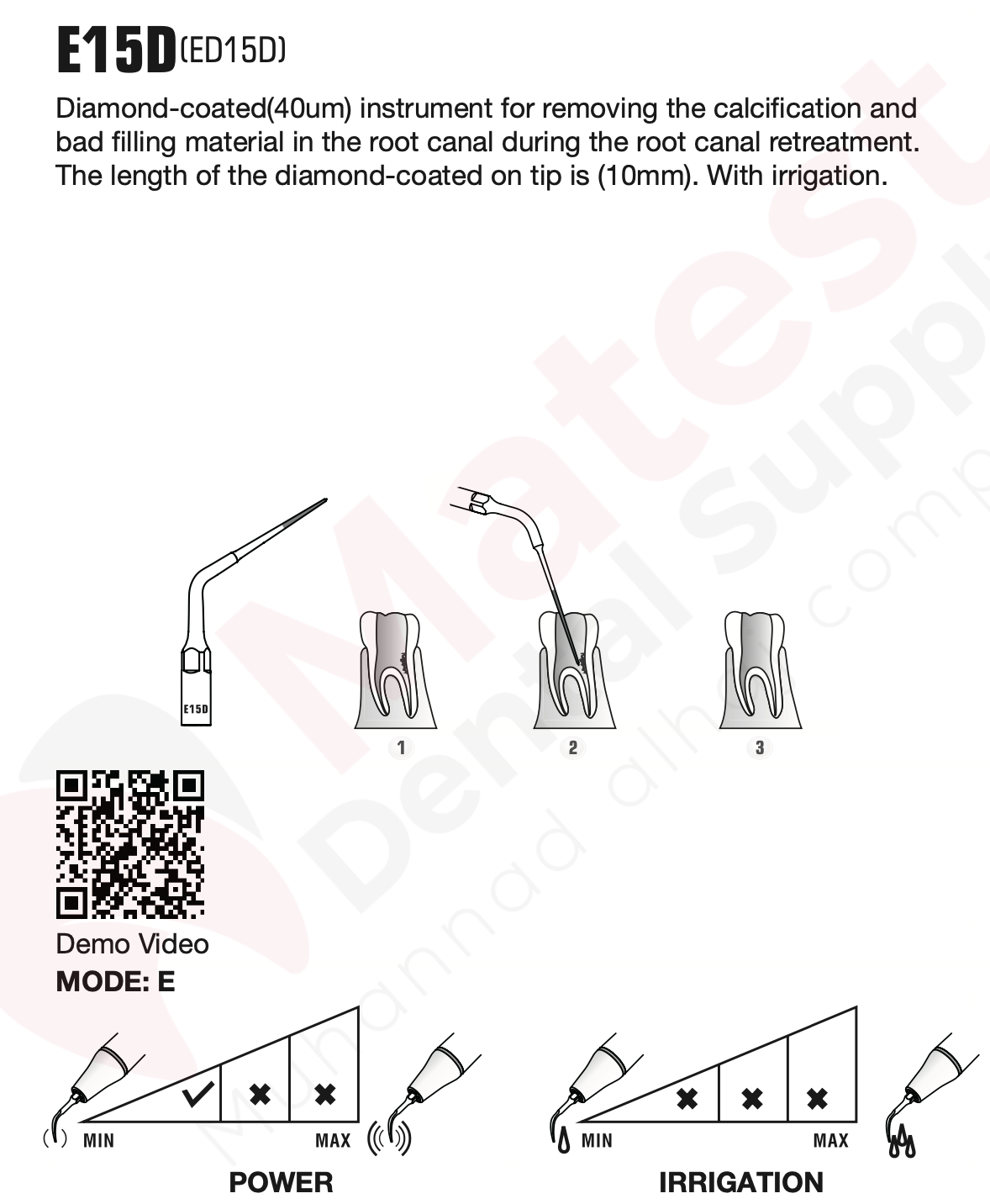 Woodpecker Endodontic UltraSonic Tips (E)