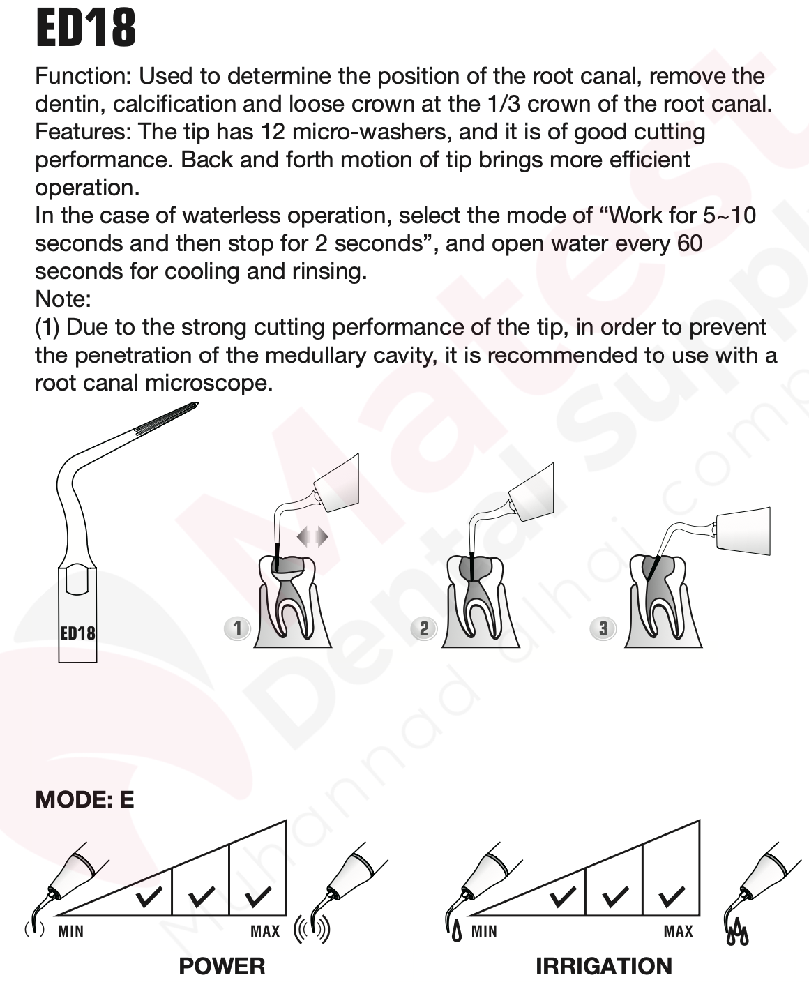 Woodpecker Endodontic UltraSonic Tips (E)