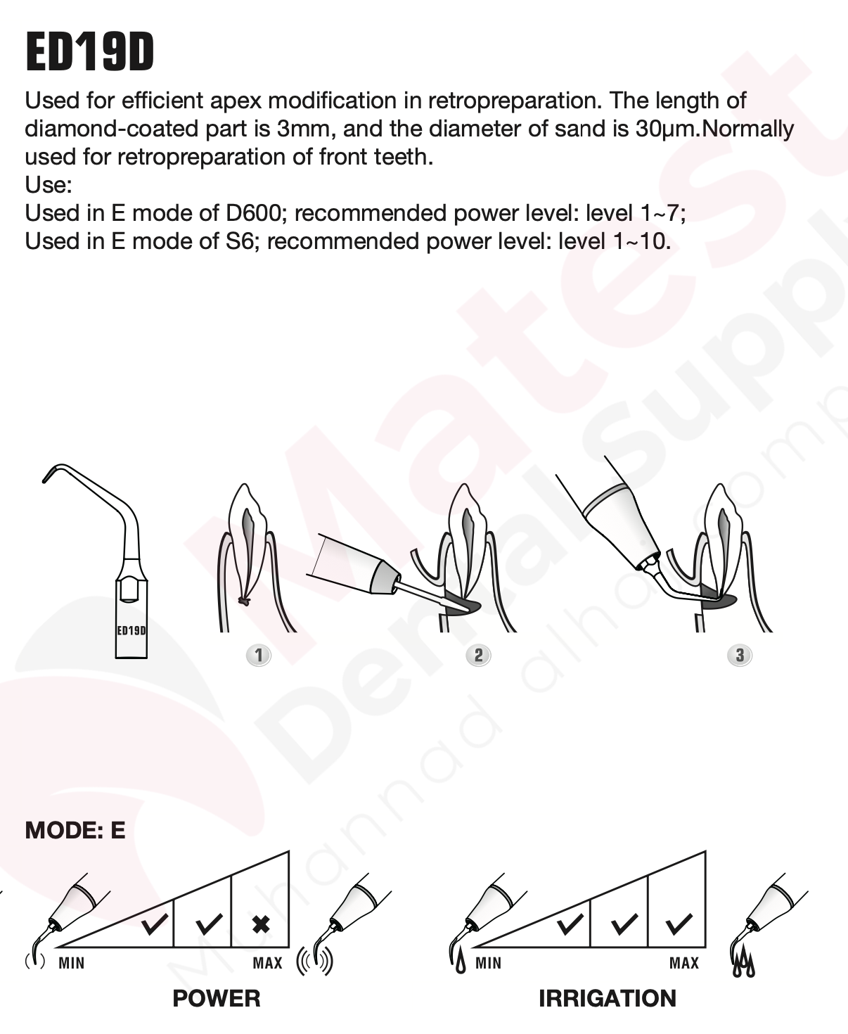 Woodpecker Endodontic UltraSonic Tips (E)