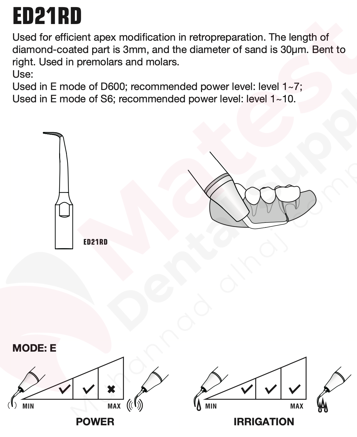 Woodpecker Endodontic UltraSonic Tips (E)