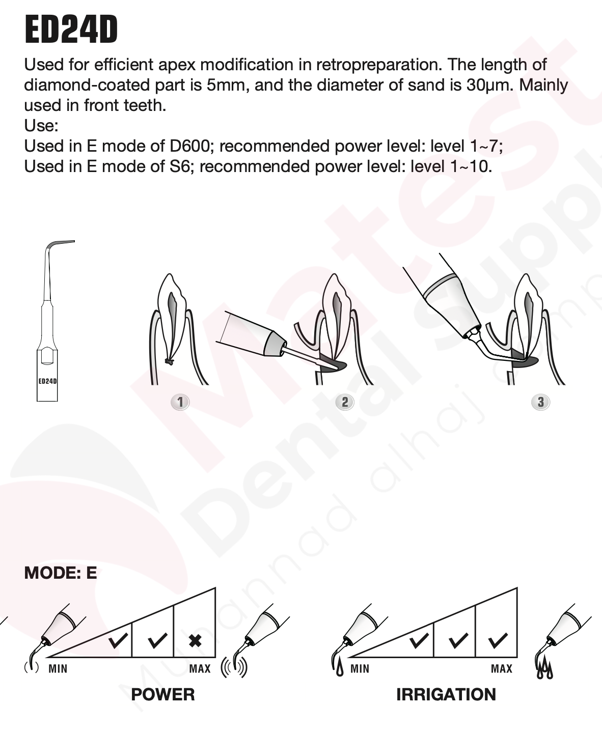 Woodpecker Endodontic UltraSonic Tips (E)