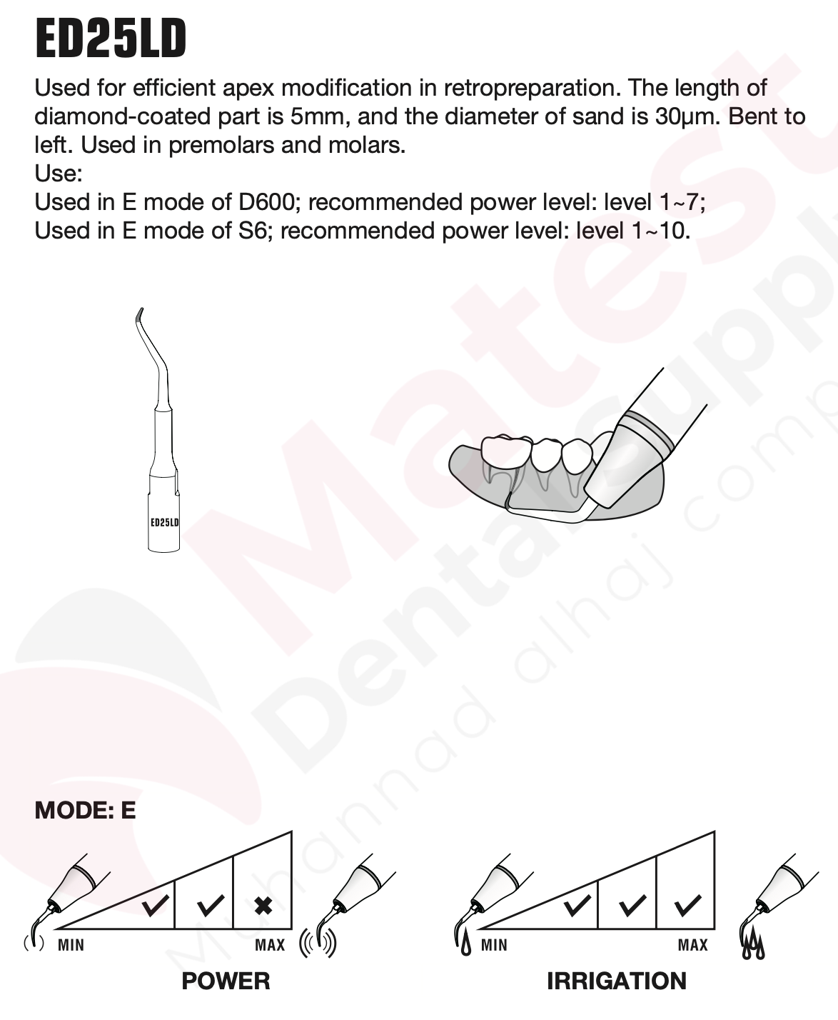 Woodpecker Endodontic UltraSonic Tips (E)