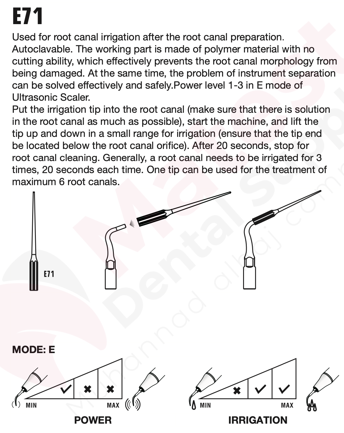 Woodpecker Endodontic UltraSonic Tips (E)