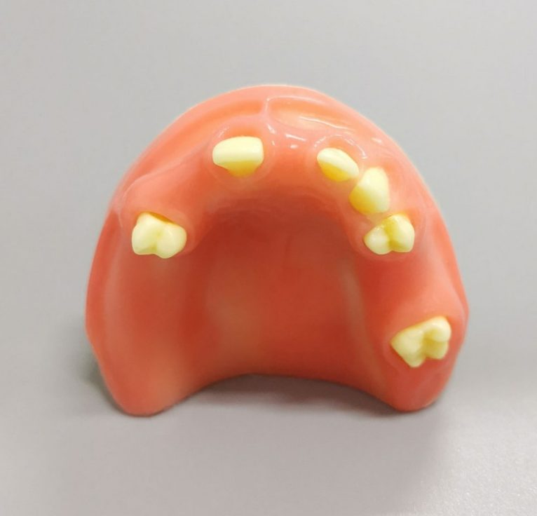 Implant Practice Model Upper Jaw Model Partially Edentulous Model