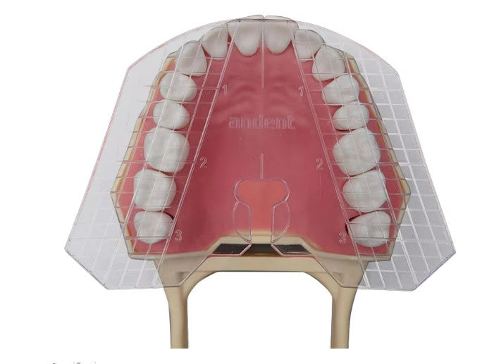 Dental Guide Plate