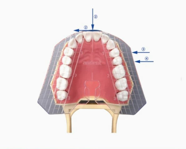 Dental Guide Plate