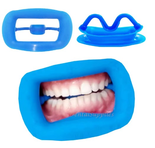 Cheek Retractor Mouth Opener