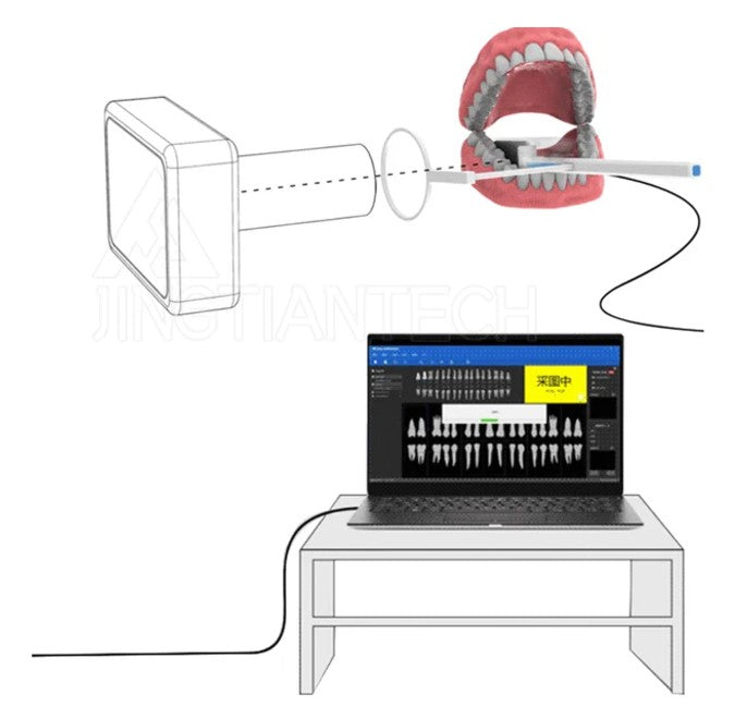 X-Ray Portable Camera