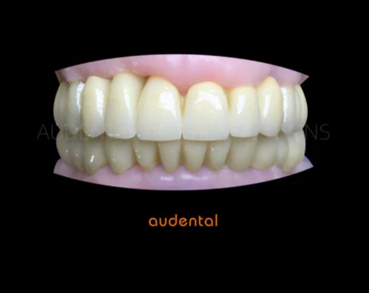 3D PRO MULTILAYER Zirconia Block A2