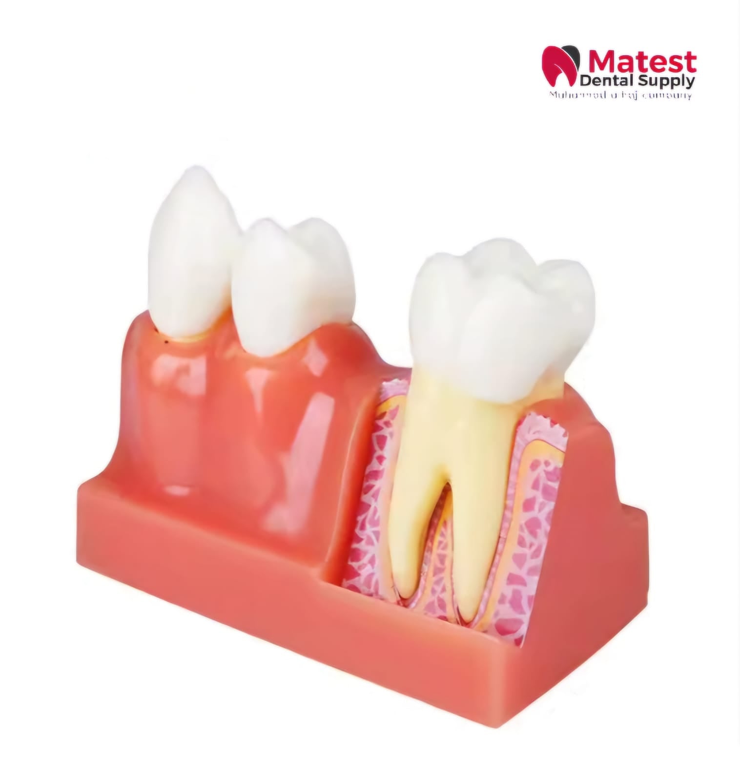 4 Times Dental Model Endodontics Anatomy Model for Dentist