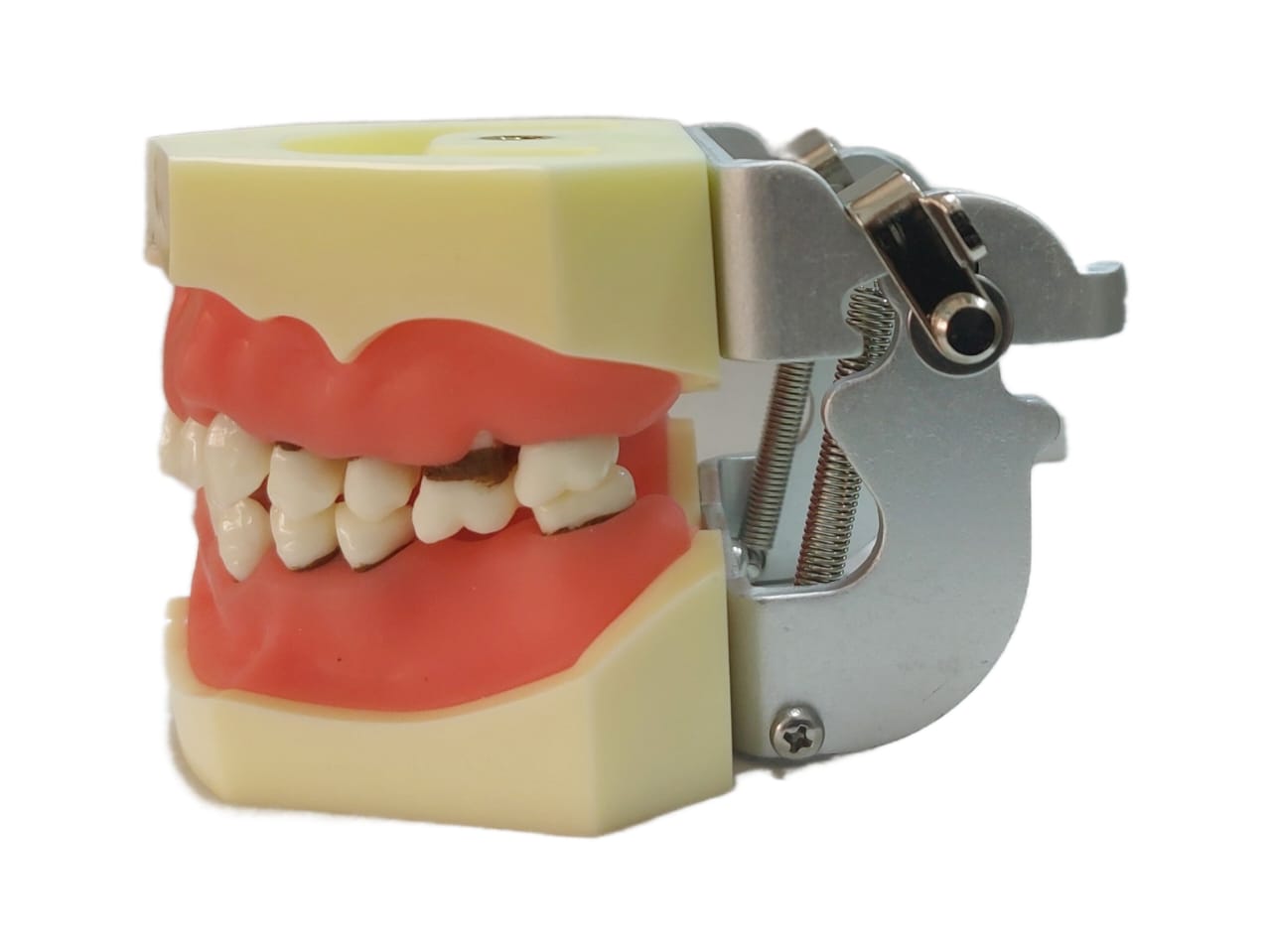 Jaw Model with Periodontal Disease