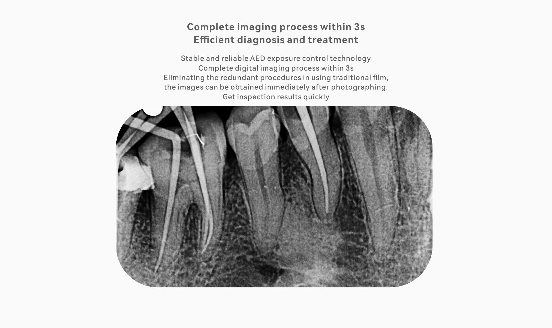 DBA - i-Sensor Digital X-ray Sensor