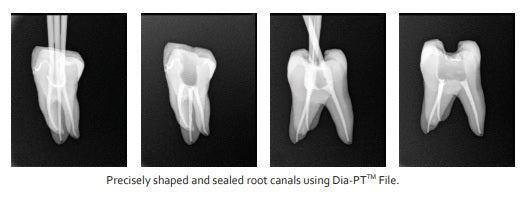 Dia-PT File Nickel Titanium Rotary Files