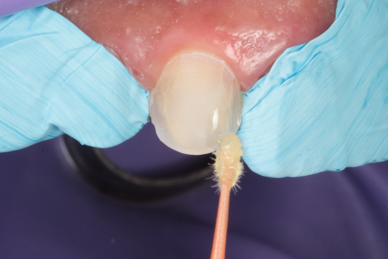 Isotape - Tape For Dental Isolation