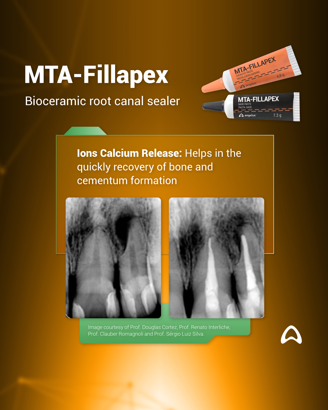 MTA-Fillapex Bioceramic root canal sealer