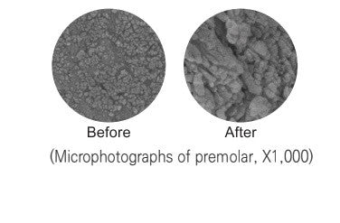 DIAETCH - 37% Etching Gel Phosphoric Acid