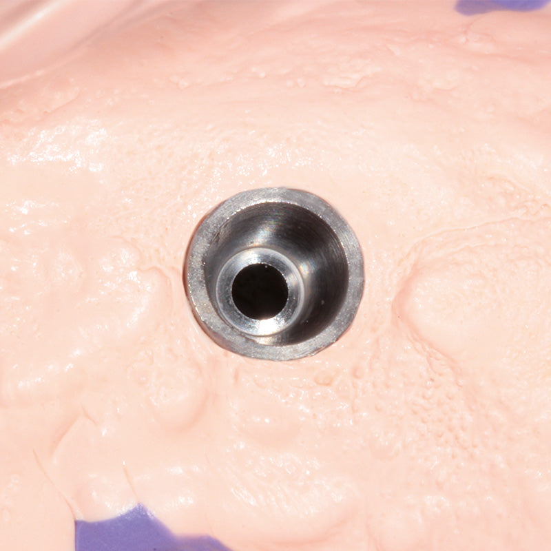 Hydrorise Implant Heavy Body – High viscosity scannable A-Silicone