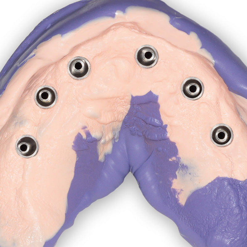 Hydrorise Implant Heavy Body – High viscosity scannable A-Silicone